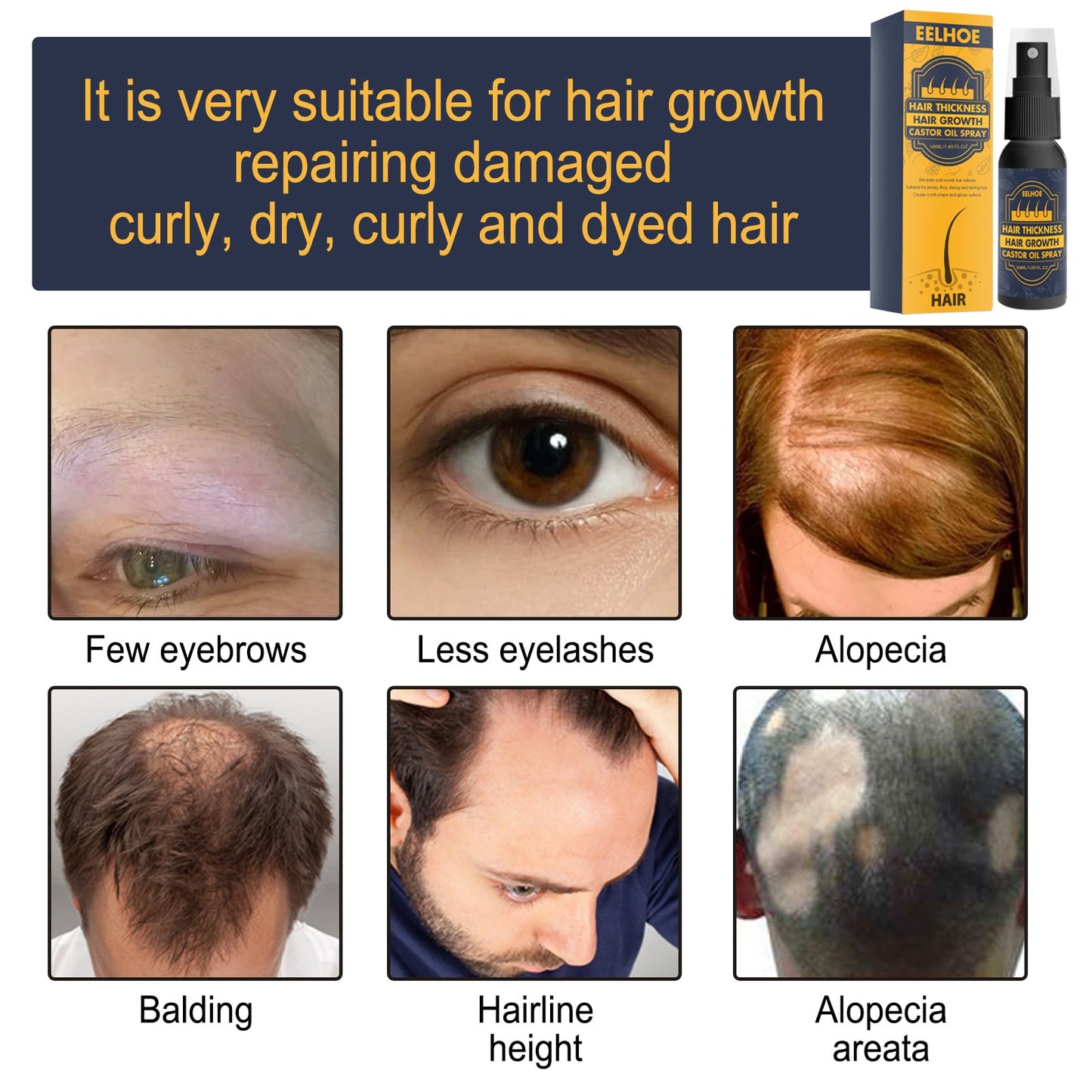 Dense Castor Oil Nutrient Solution, Hair Prevention, Moisturizing Hair Follicles Massage Repair Hair Hair - Korvel