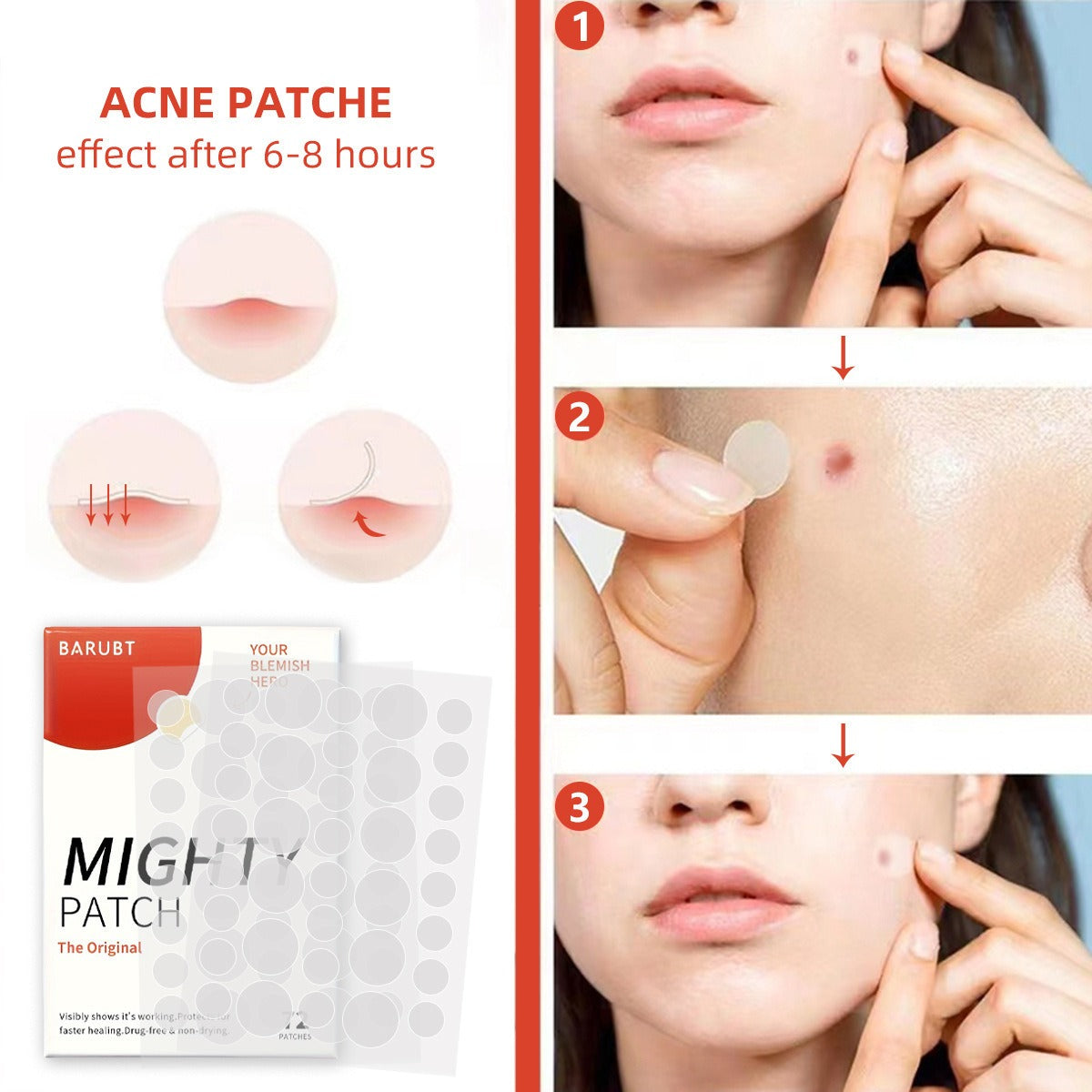 Youbuy Invisible Acne Patch Concealer - 72 Patches