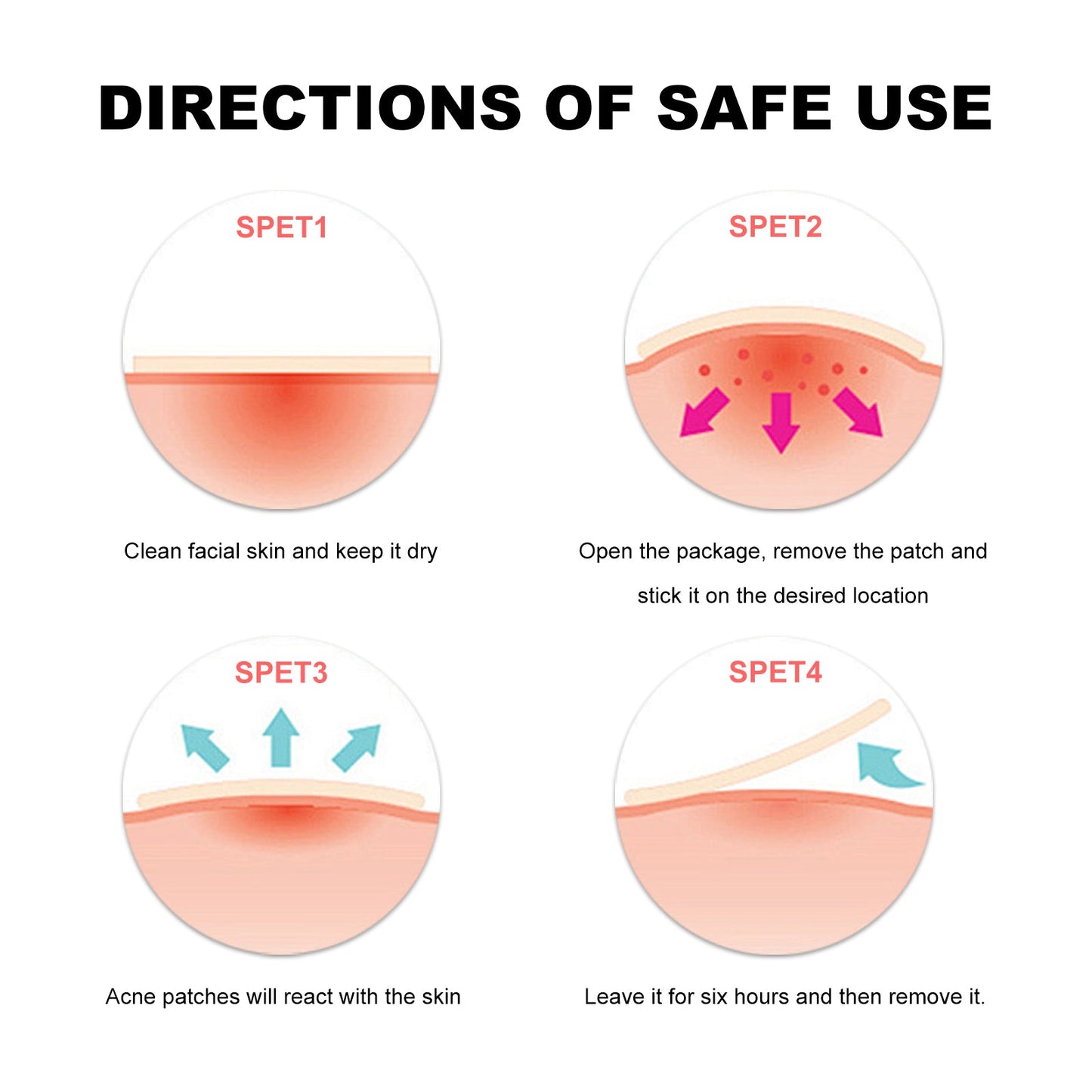Sea Life Pattern Acne Patches, Lighten Acne Acne Repair Facial Skin Concealer Acne Patch - Korvel