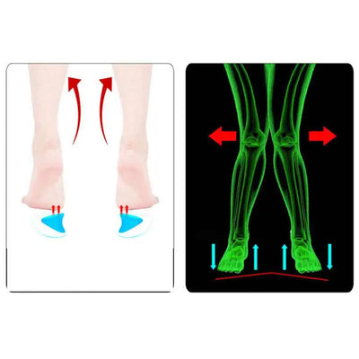 Premium Arch Support Insoles for Enhanced Comfort