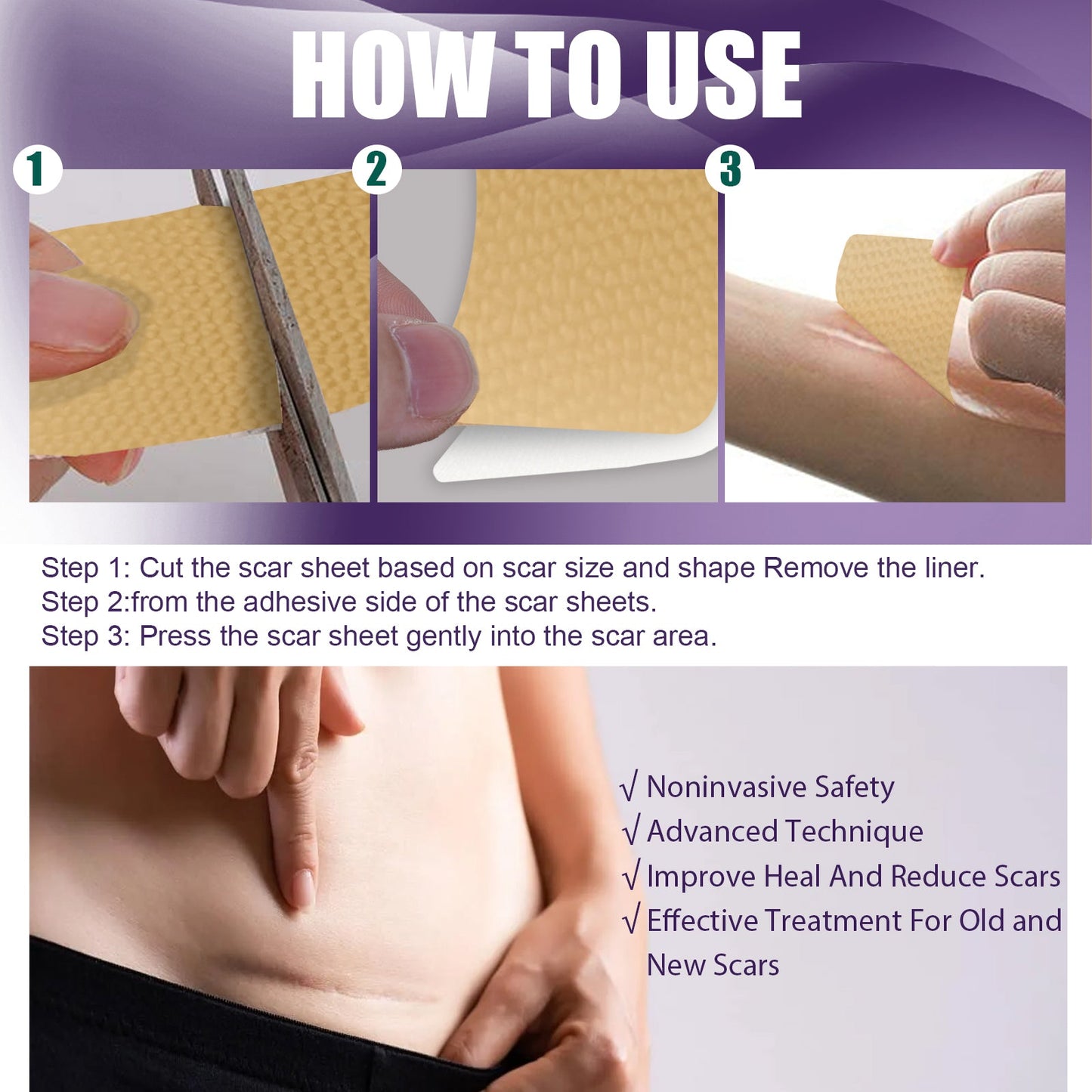 Silicone Scar Patch, Reduces Stretch Marks And Hyperplasia Of Caesarean Section Scars Silicone Patch - Korvel