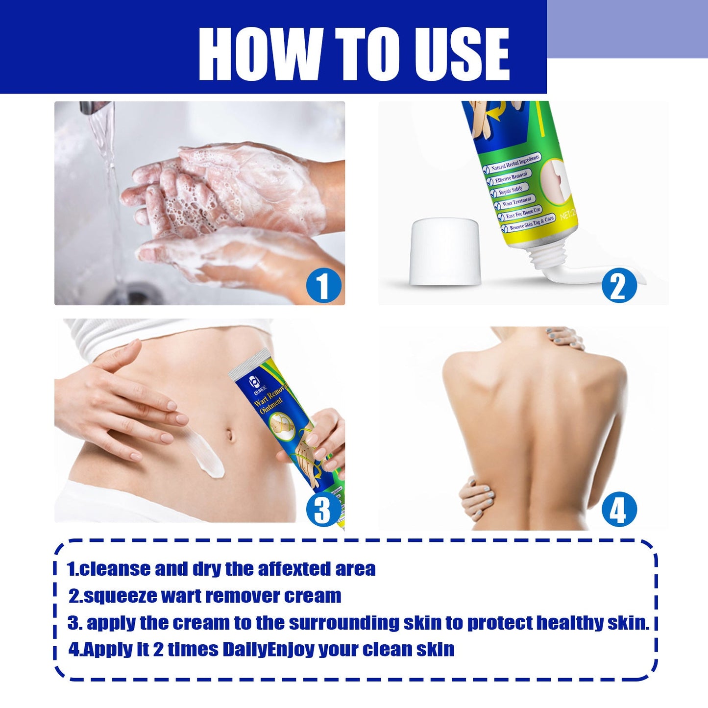 Wart Remover Ointment, Remove Hou Warts Flat Corn Plaster Flat Grains Warts, Foot And Repair Skin Dot Mole G Wart Cream - Korvel