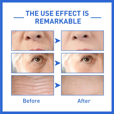 Anti-Aging Collagen Serum with Nicotinamide, Vitamin C, Hyaluronic Acid - Reduce Dark Spots, Cleanse & Tighten Skin - Korvel