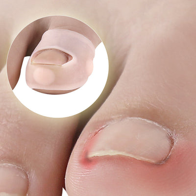 Silicone Nail Corrector for Comfortable Foot Care