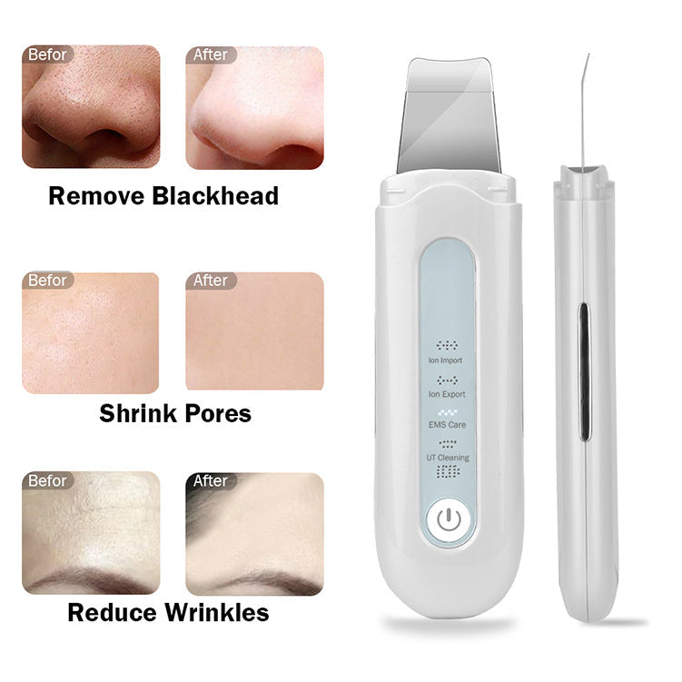 HailiCare Ultrasonic Peeling Machine for Skin Cleansing