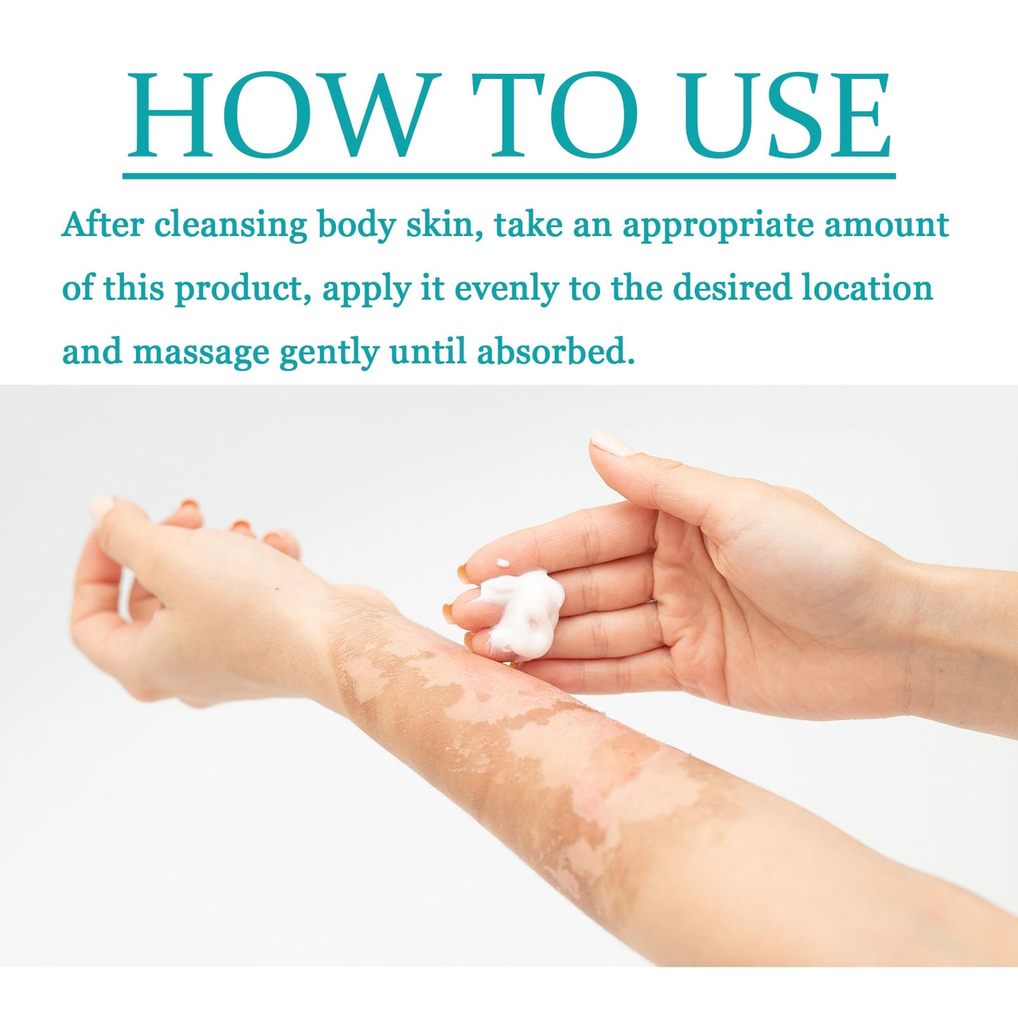 Vitiligo Fix Revitalizing Elixir, Lighten Skin Spots Even Skin Tone Moisturizing Body Care Repair Cream - Korvel