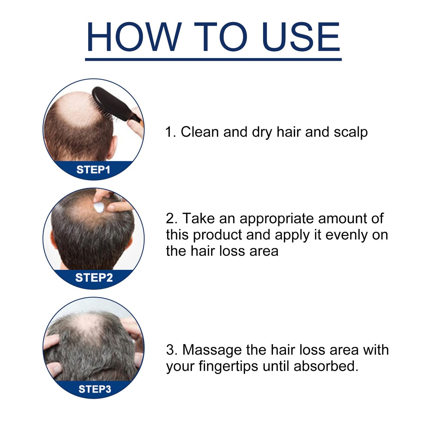 Alopecias Hair Growth Cream, Protect Hair Follicles Strong Moisturizing Thick Hairline Hair - Korvel