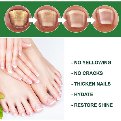 Nail Care Liquid Hand and Foot Nail Care Liquid Daily Cleaning Nail Brightness Soft Nail Moisturizing Nail - Korvel