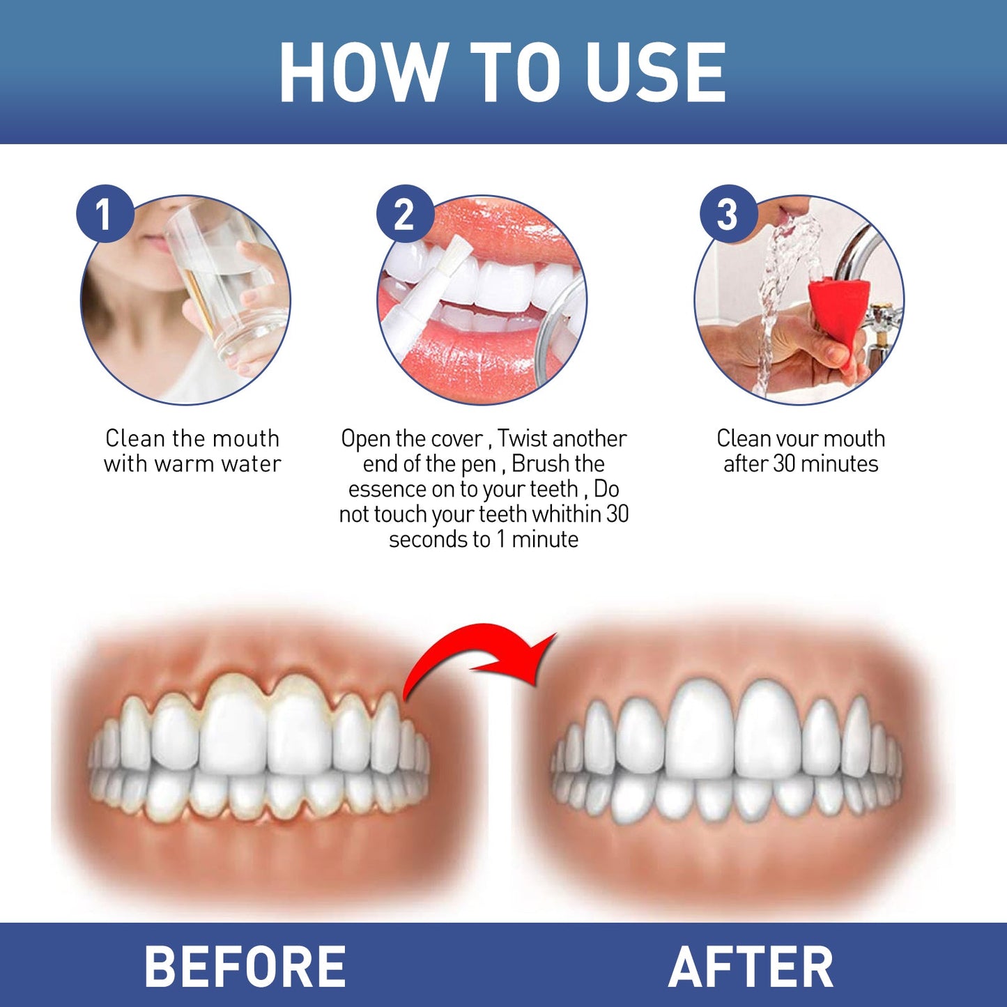 WestMonth Gum Instant Soothing Gel, Relieve Gums Swelling And Pain Clean Teeth Plaque Stains And Whiten Teeth Gel - Korvel