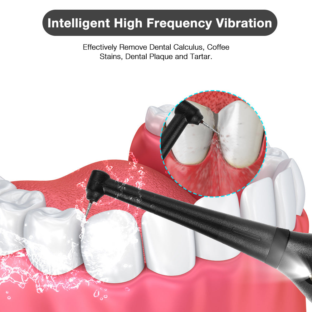 Portable Electric Tooth Scaler Dental Care Tool Adult Beauty Tooth Scaler To Remove Calculus - Korvel