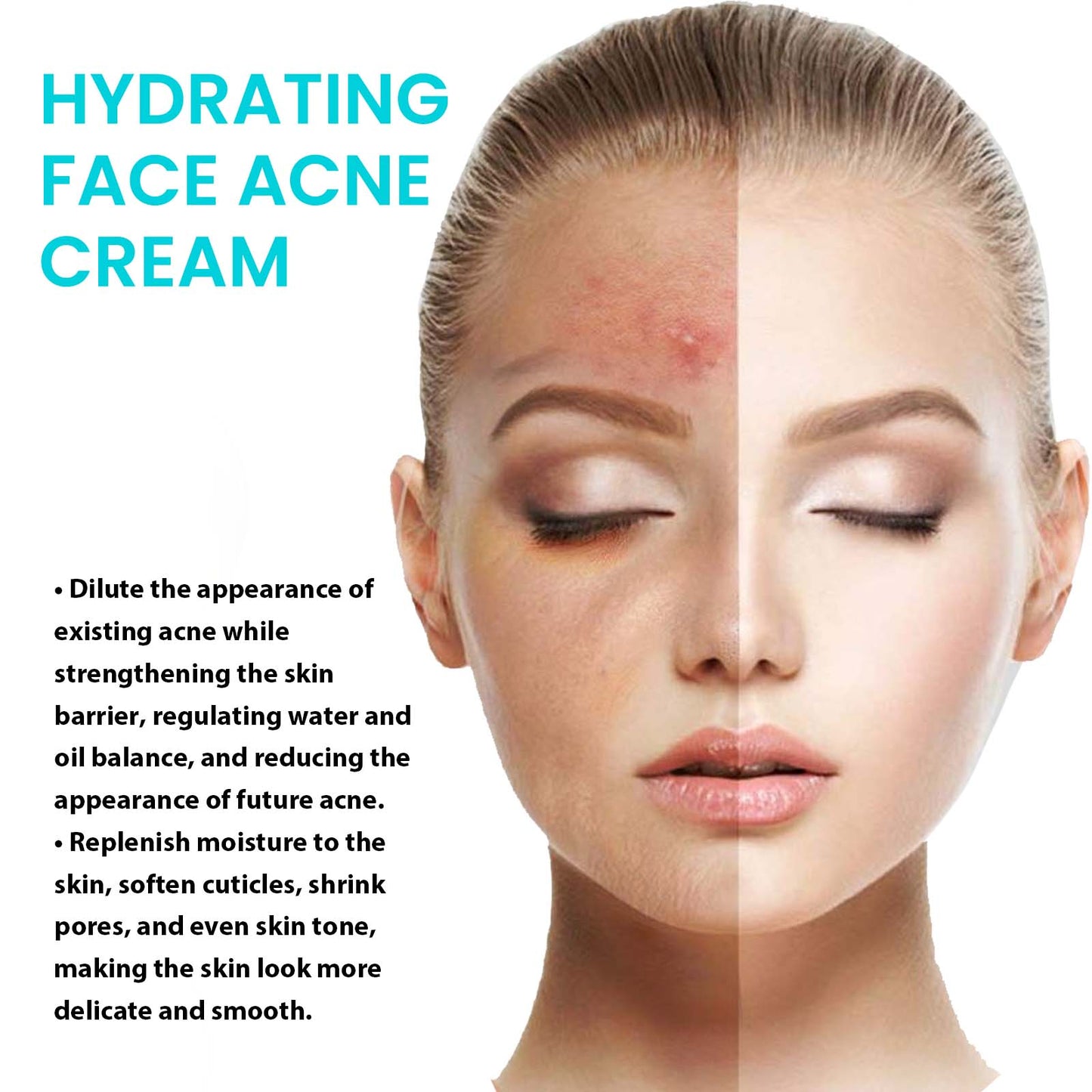 Brightening Anti-Acne Cream, Lighten Acne Pimples, Shrink Pores, Moisturize Skin Brightening Cream - Korvel