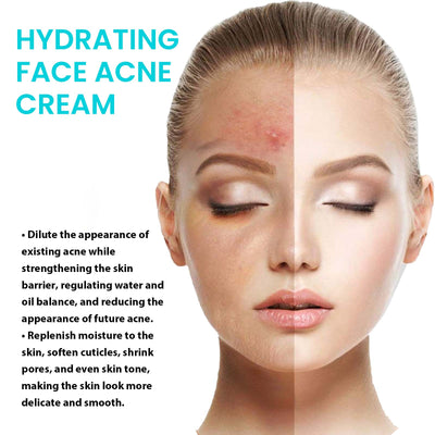 Brightening Anti-Acne Cream, Lighten Acne Pimples, Shrink Pores, Moisturize Skin Brightening Cream - Korvel