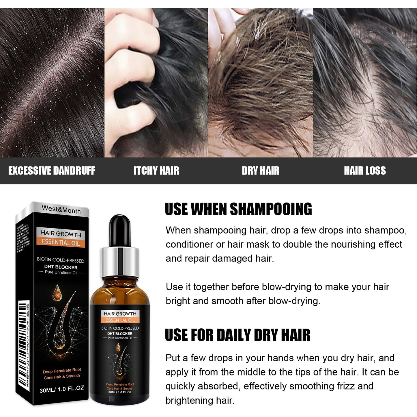Hair Growth Essential Oil, Dense Hair Growth Repair Dry Hair And Moisture Hair Essence - Korvel