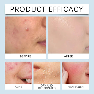 Hyaluronic Acid Face Serum, Radiant Facial Skin Improves Skin Pores And Hydrates - Korvel