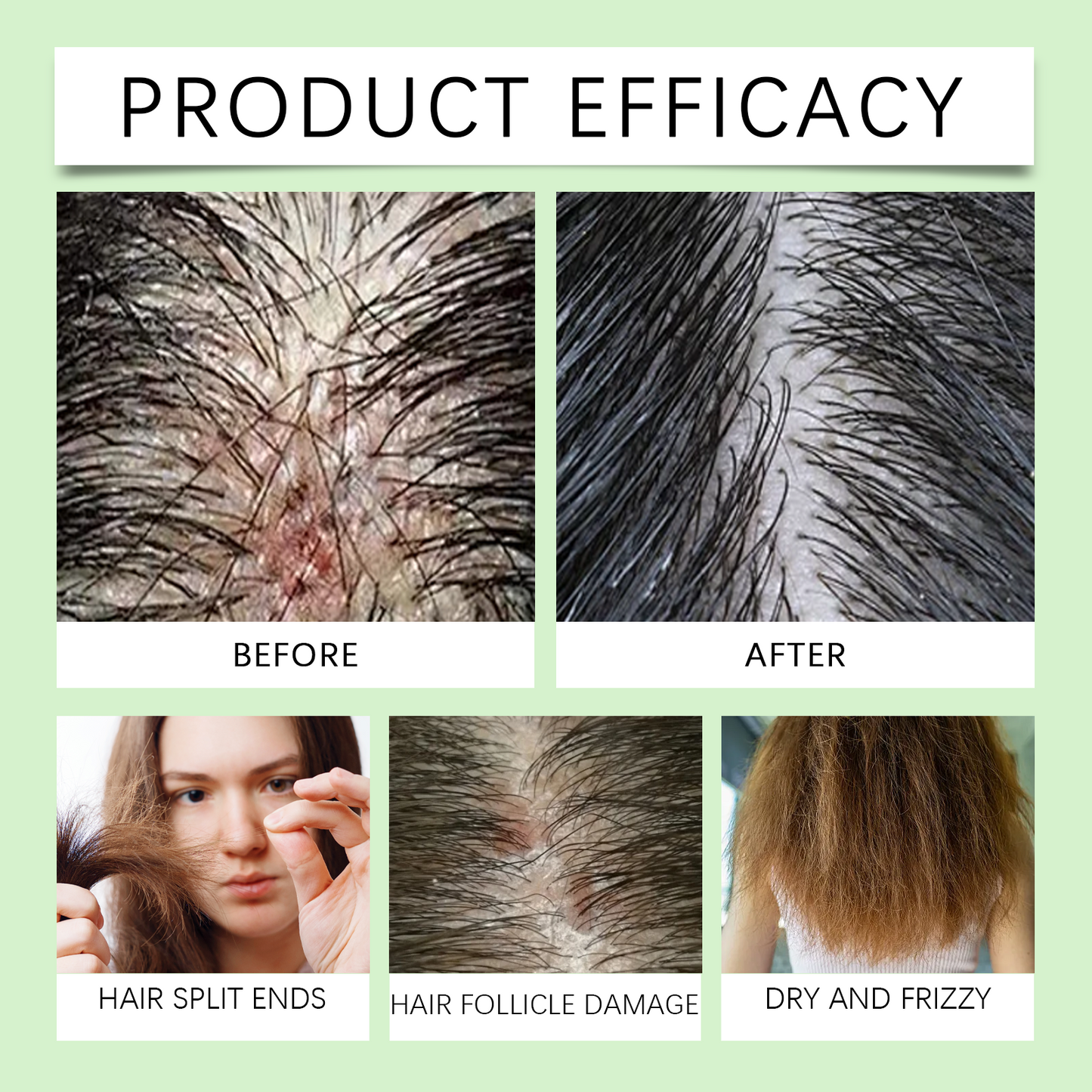 Hair Care Conditioner Scalp Root Care Care Nourishes Hair Follicles Hair Shine Conditioner - Korvel