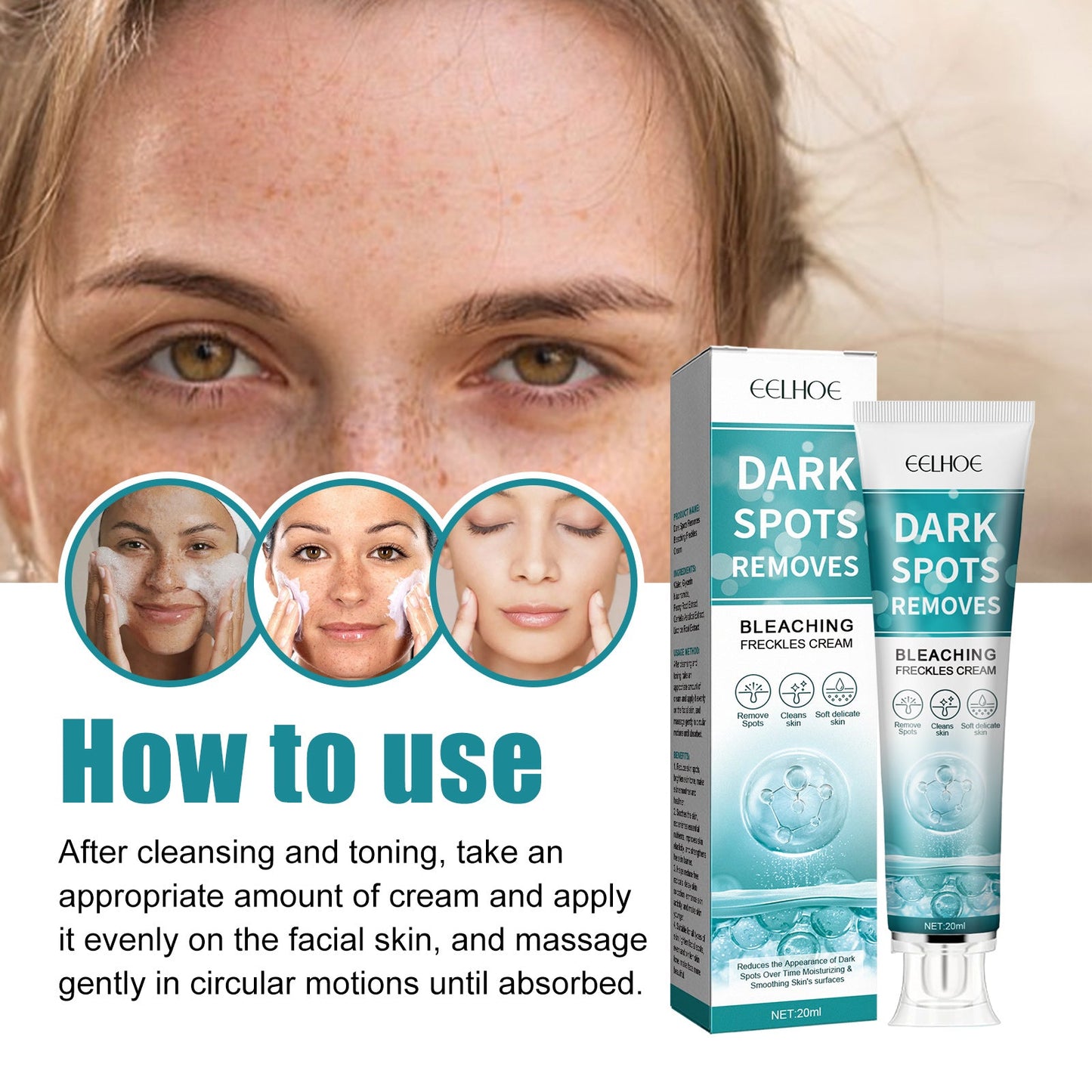 Whitening Spot Cream Hydrates And Moisturizes Skin To Lighten Spots, Acne Whitening, Brightening And Rejuvenating Skin Beauty Cream - Korvel