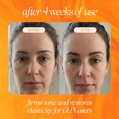 Bakuchiol Skin Renewing Facial Oil