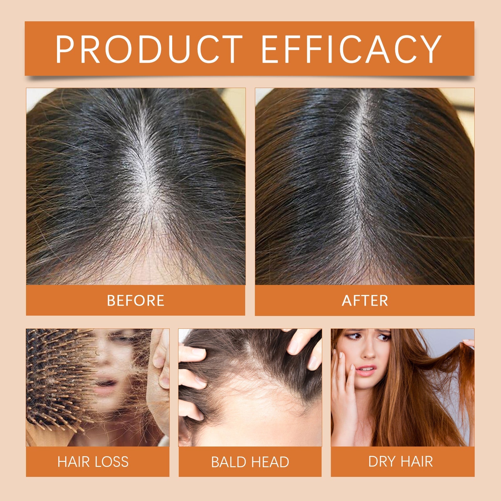 Hair Regrowth Ampoules, Nourish The Scalp To Promote Germinal Nourish Hair Follicle Health Care Essence - Korvel