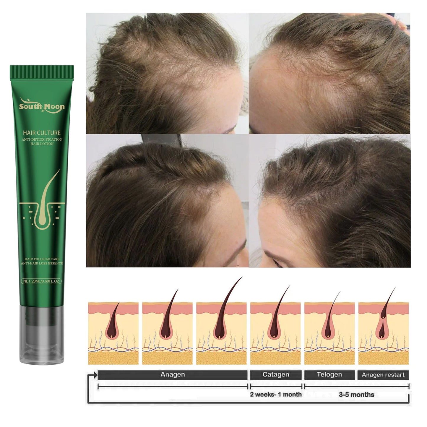 Scalp Essence Ginger Gently Moisturizes And Moisturizes Dry And Dry Hair - Korvel