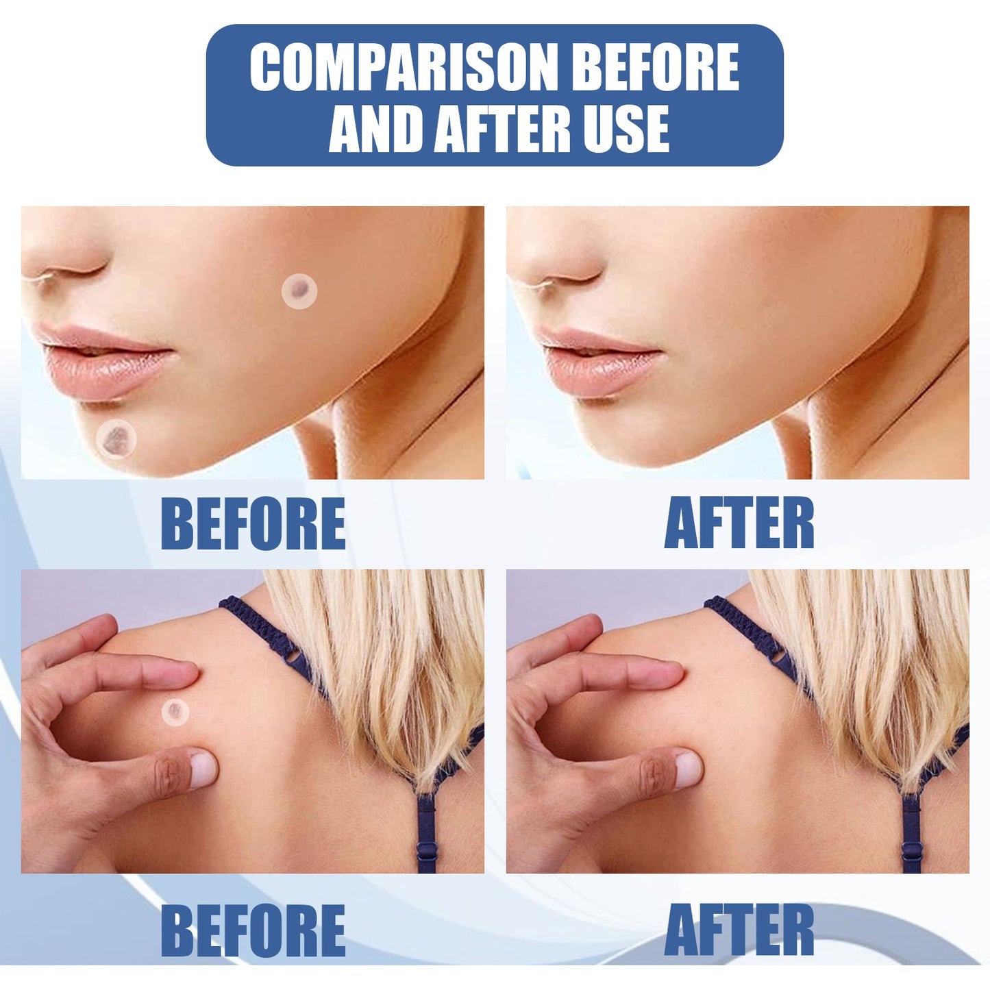 Kew Patch Gentle Cleaning Care Skin Face Neck Repair Smooth Skin Daily Care - Korvel