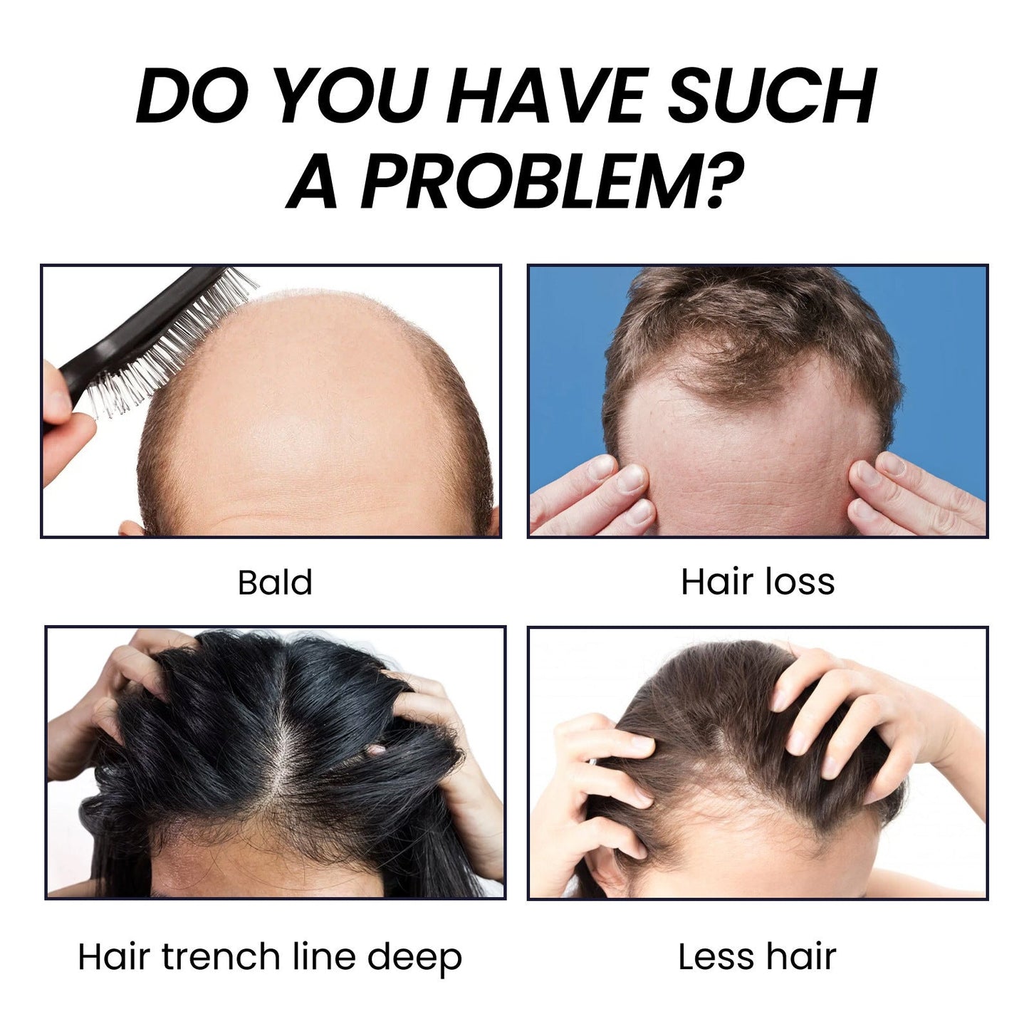 Hair Boost Spray with Ginger Essence for Scalp Care