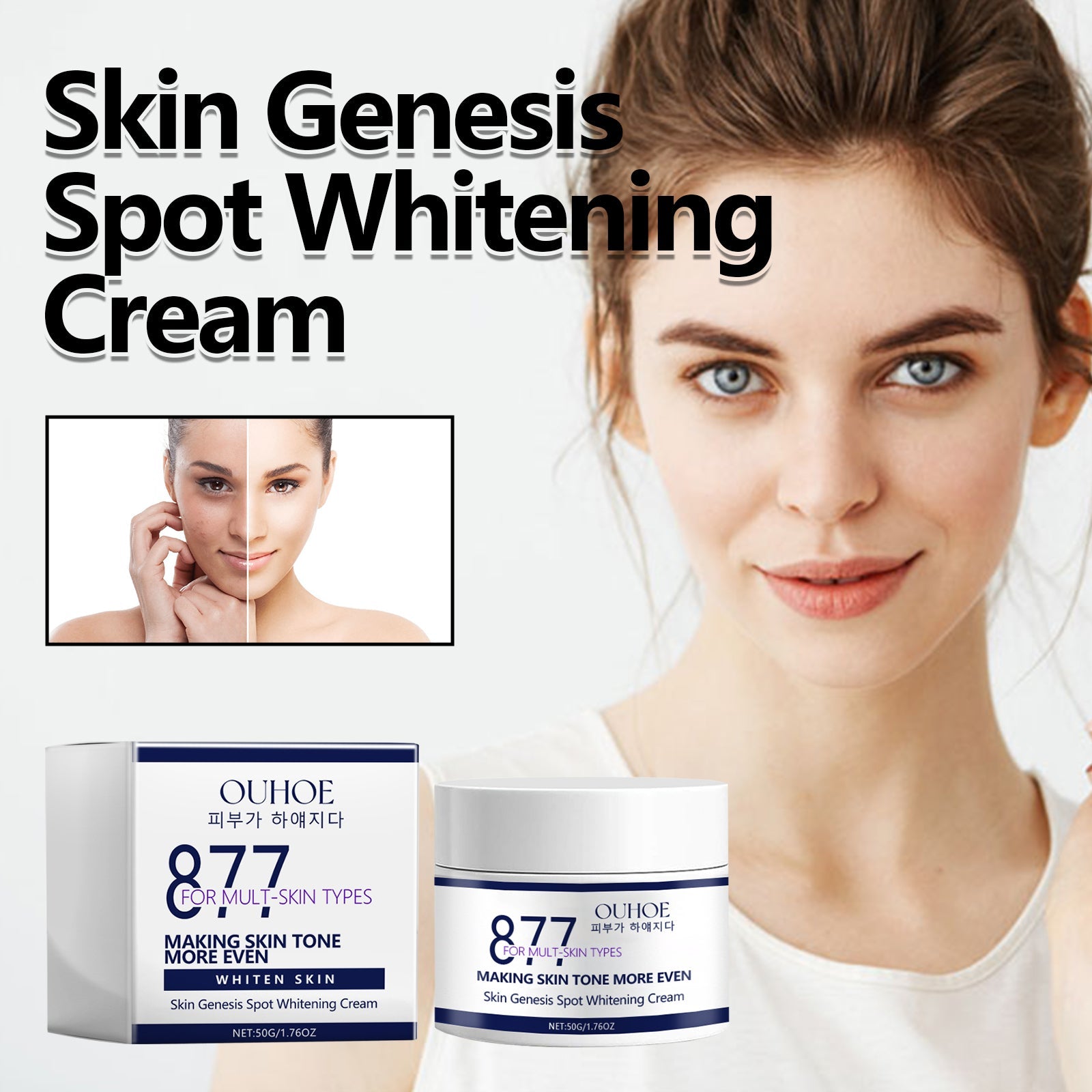 Skin Genesis Spot Whitening Cream, Moisturizing and rejuvenating Skin Whitening body Skin care cream - Korvel