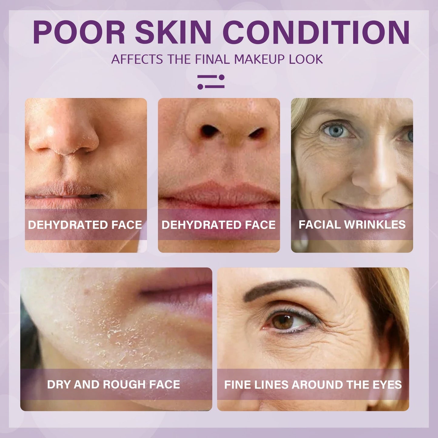 Moisturizer Improves Dry Skin Cream Tightens And Lightens Wrinkles Hydrating Moisturizing Moisture Easy To Absorb - Korvel
