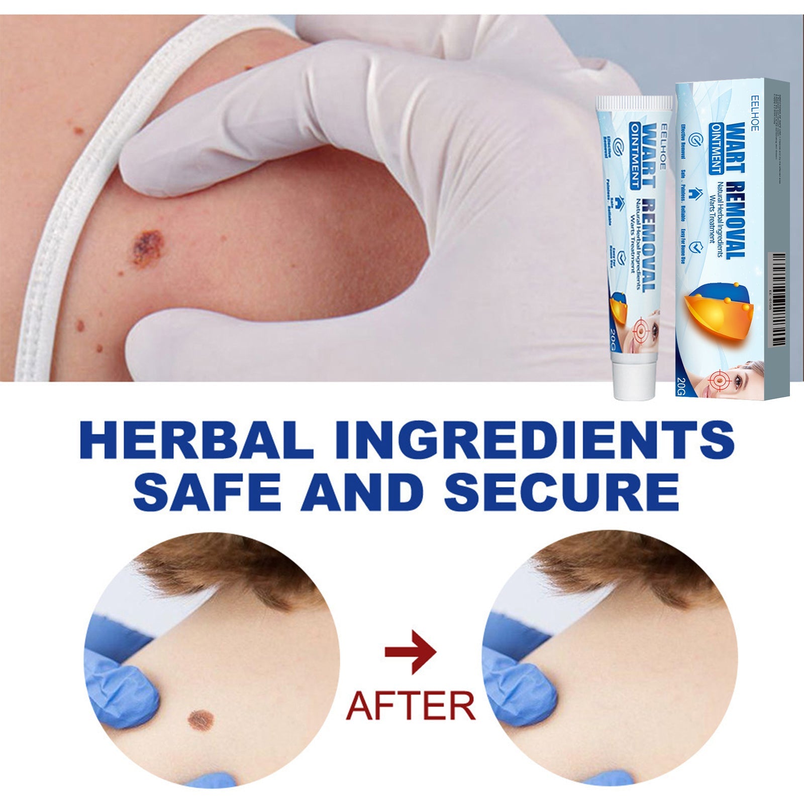 Keyu Cream Clean Skin Repair Care Body Face Remove Face Label Keyu Cream - Korvel