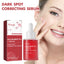 Dark Spots Repair Essence, Moisturizing And Brightening Repair Essence For Dark Spots And Age Spots - Korvel
