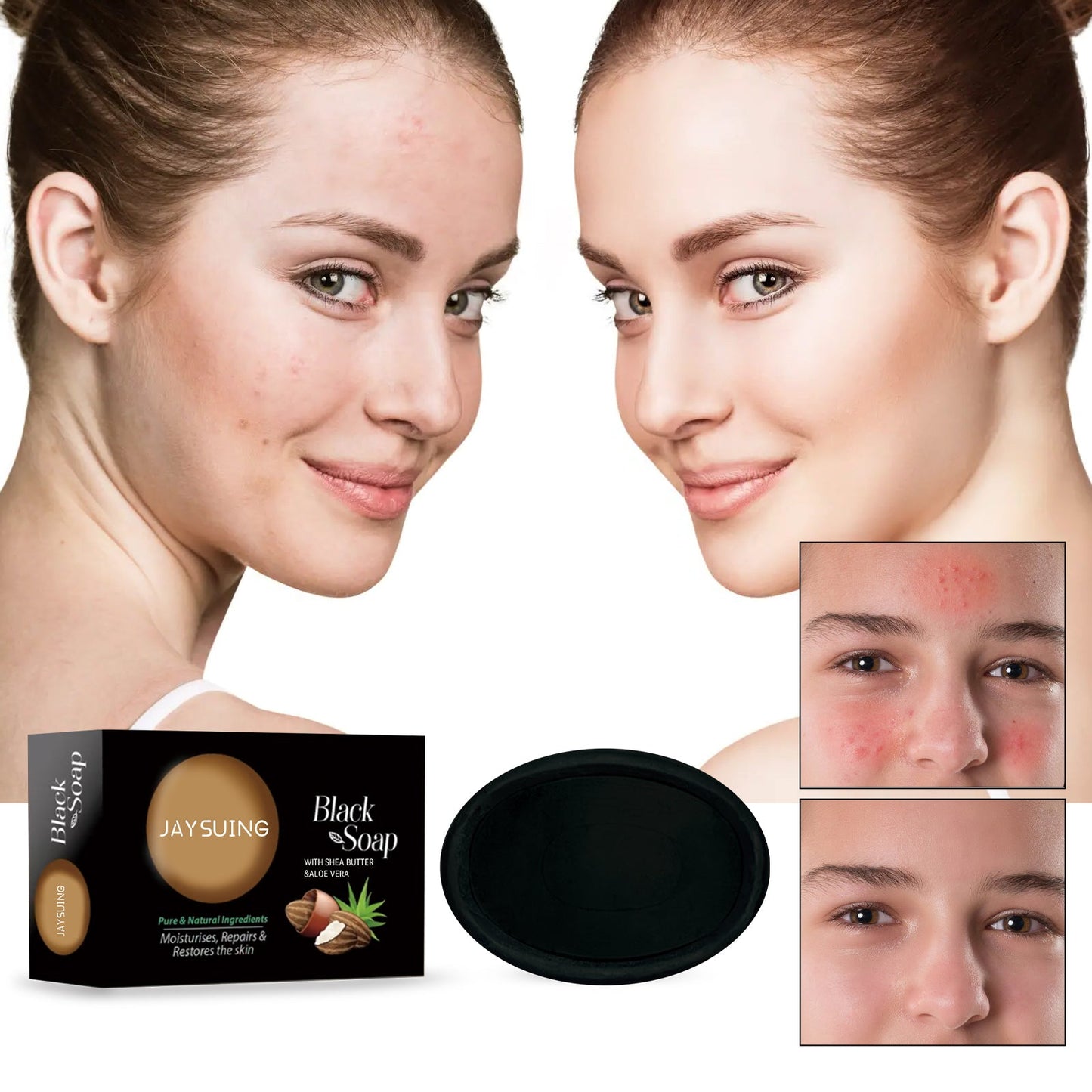 Shea Butter Black Soap, Repair Acne Pimple Acne Clear Pores Moisturize Smooth Skin Soap - Korvel