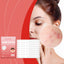 Semi-Transparent Acne Cover Patch - Comfortable & Waterproof