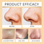 Enzymes Exfoliating Brightening Gel, Gentle Exfoliating Cleansing Gel Deeply Purifies Pores, Removes Blackheads And Brightens Skin - Korvel