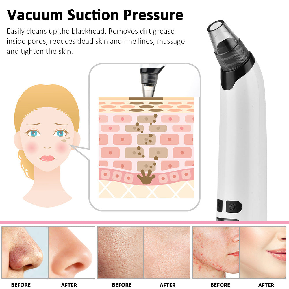 HailiCare Heating Blackhead Removal Instrument