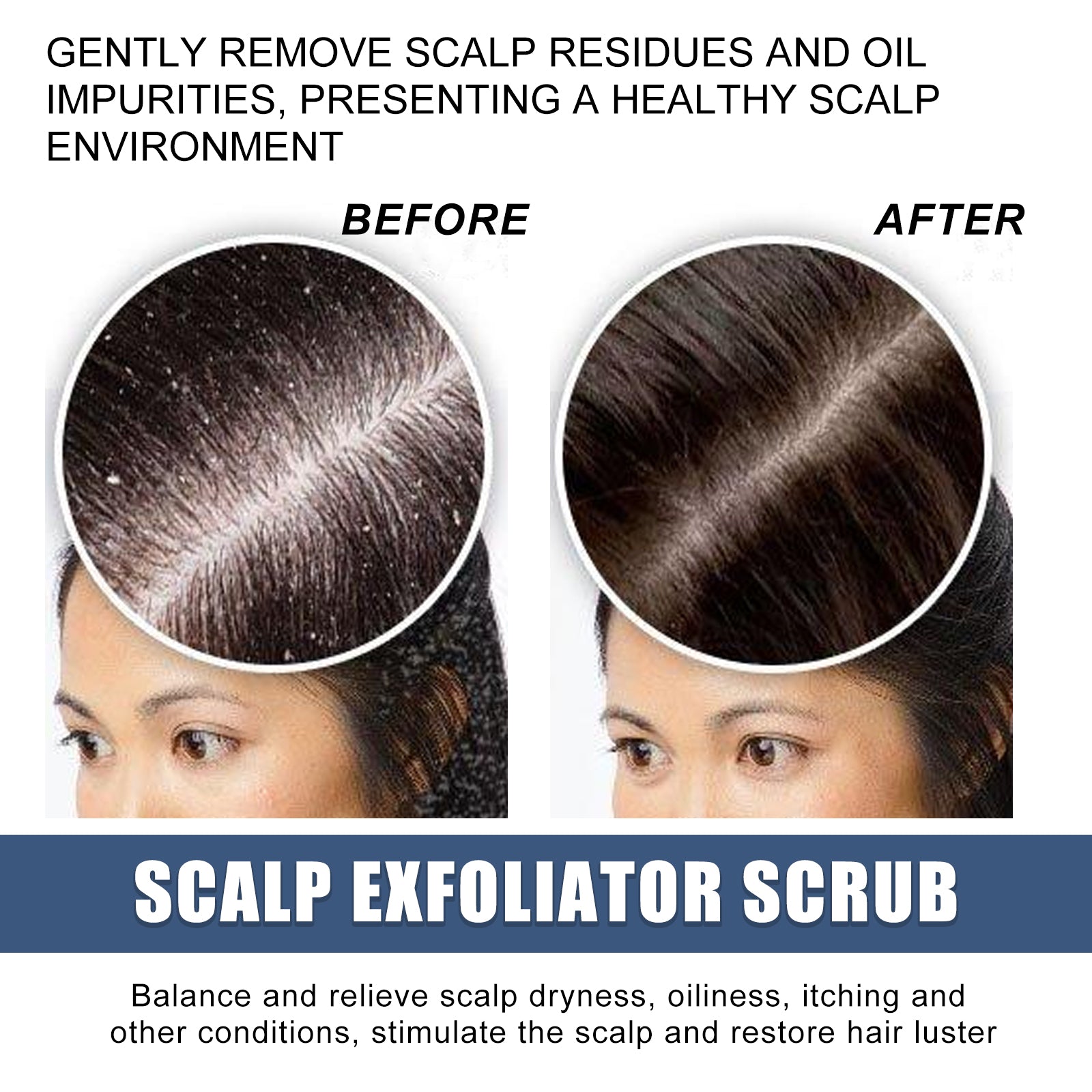 Scalp Exfoliating Scrub Moisturizes Dry Hair And Scalp Cleansing Treatment Refreshing Scrub - Korvel