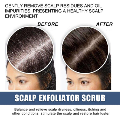 Scalp Exfoliating Scrub Moisturizes Dry Hair And Scalp Cleansing Treatment Refreshing Scrub - Korvel
