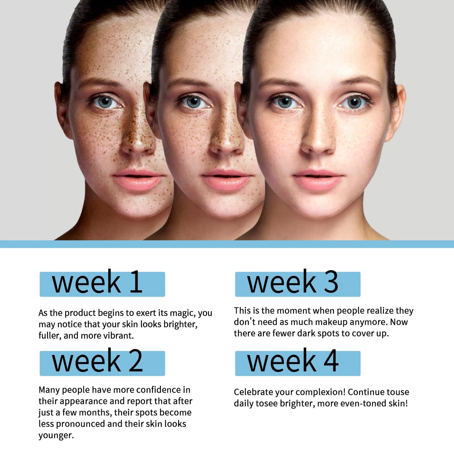 Dark Spot Lightening Cream Lightening Dark Spot Melasma Repairing Dull And Even Skin Tone Brightening Cream - Korvel