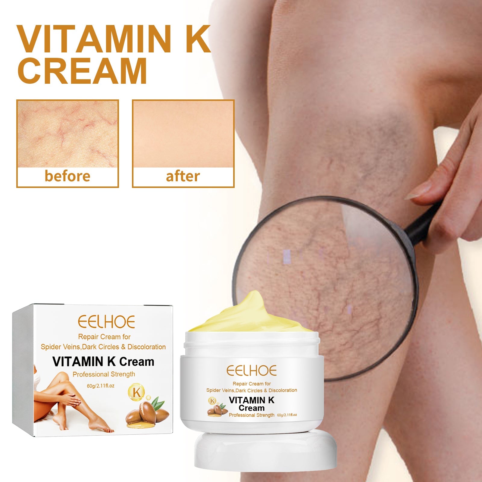 Vitamin K Cream Skin Care For Sore And Swollen Legs Earthworm Leg Vein Massage Cream - Korvel