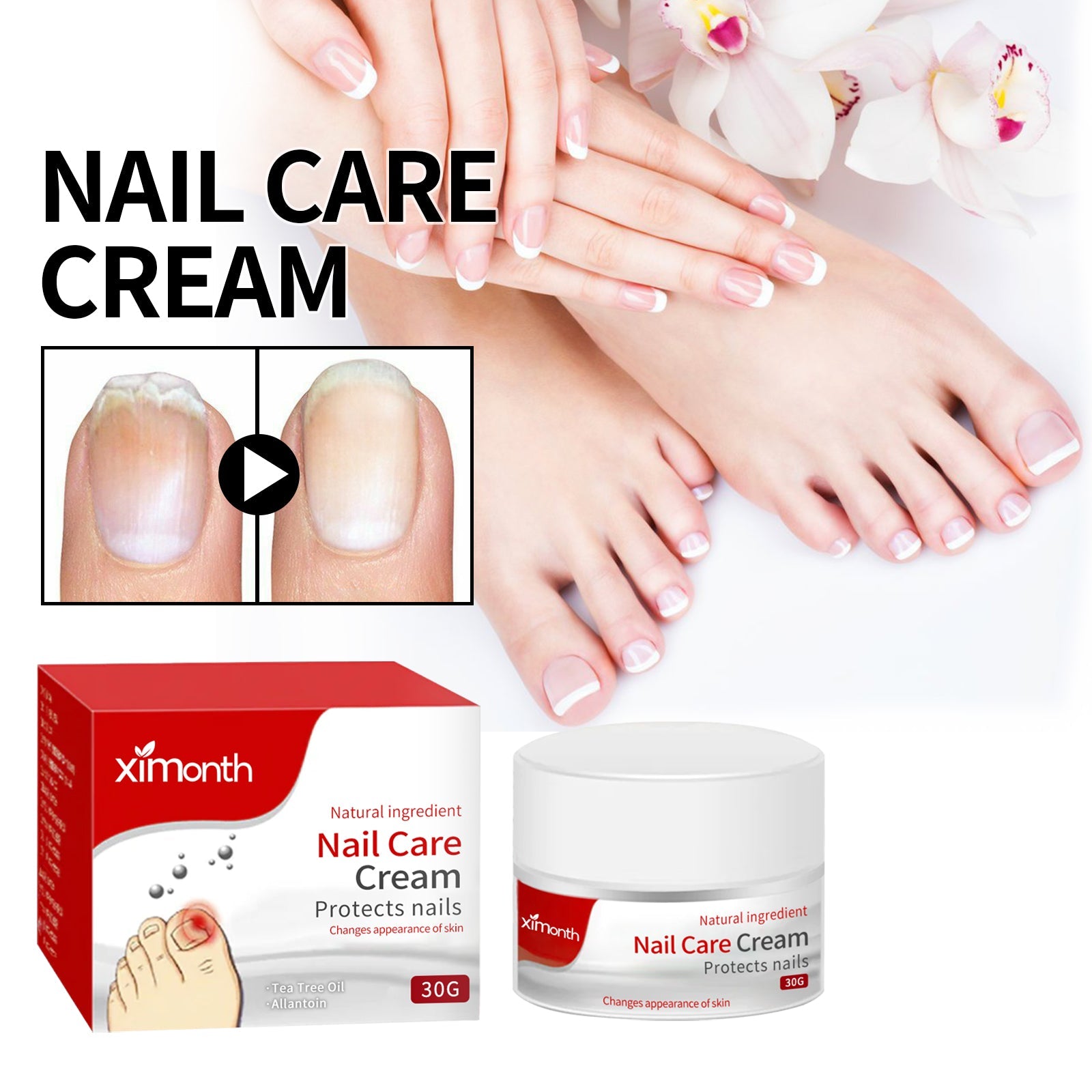 Nail Care Cream, Light Armor Repair Bad Ingrown Nail Nails Brothers Nail Thickening A Ditch Nursing - Korvel