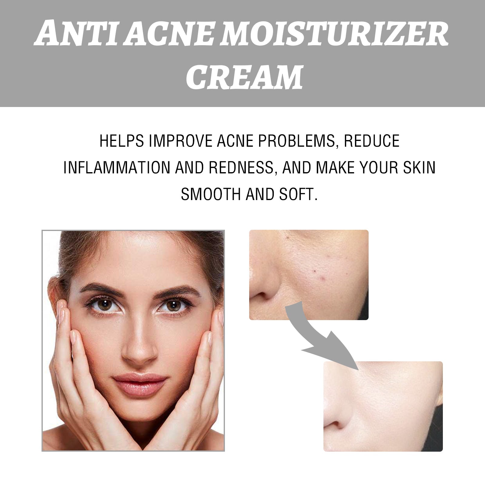 Hydrating Cream Hydrating And Lightening Facial Acne Repair Redness Hydrating And Brightening Moisturizing Cream - Korvel