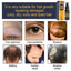Dense Castor Oil Nutrient Solution, Hair Prevention, Moisturizing Hair Follicles Massage Repair Hair Hair - Korvel