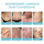 Scarfree Advanced Skin Spray, Body Skin Care Reduces Post-Natal Scars And Smooths Skin - Korvel