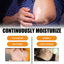 Bee Venom Psoriasis Care Spray, Soothing Skin Irritation Repair Moisturizing And Tender Skin Care Spray - Korvel