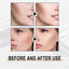 Lactose Solution, Exfoliate Remove Blackheads Shrink Pores Clean And Moisturize SkinEssence - Korvel