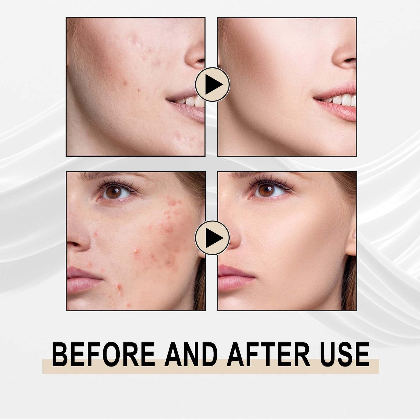 Lactose Solution, Exfoliate Remove Blackheads Shrink Pores Clean And Moisturize SkinEssence - Korvel
