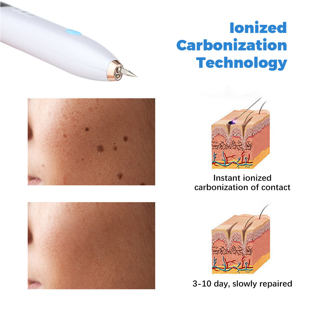 Removal Of Granulation Wart Tattoo Wart Spot Plug-In 9-Speed Laser Sweep Spot Mole Pen With Point Mole Pen Needle - Korvel