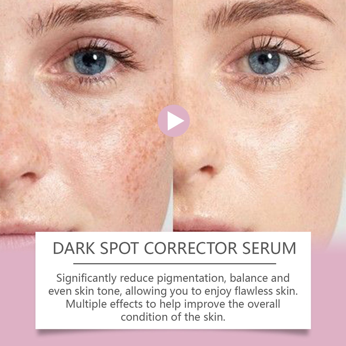 Premium Patch Repair Cream