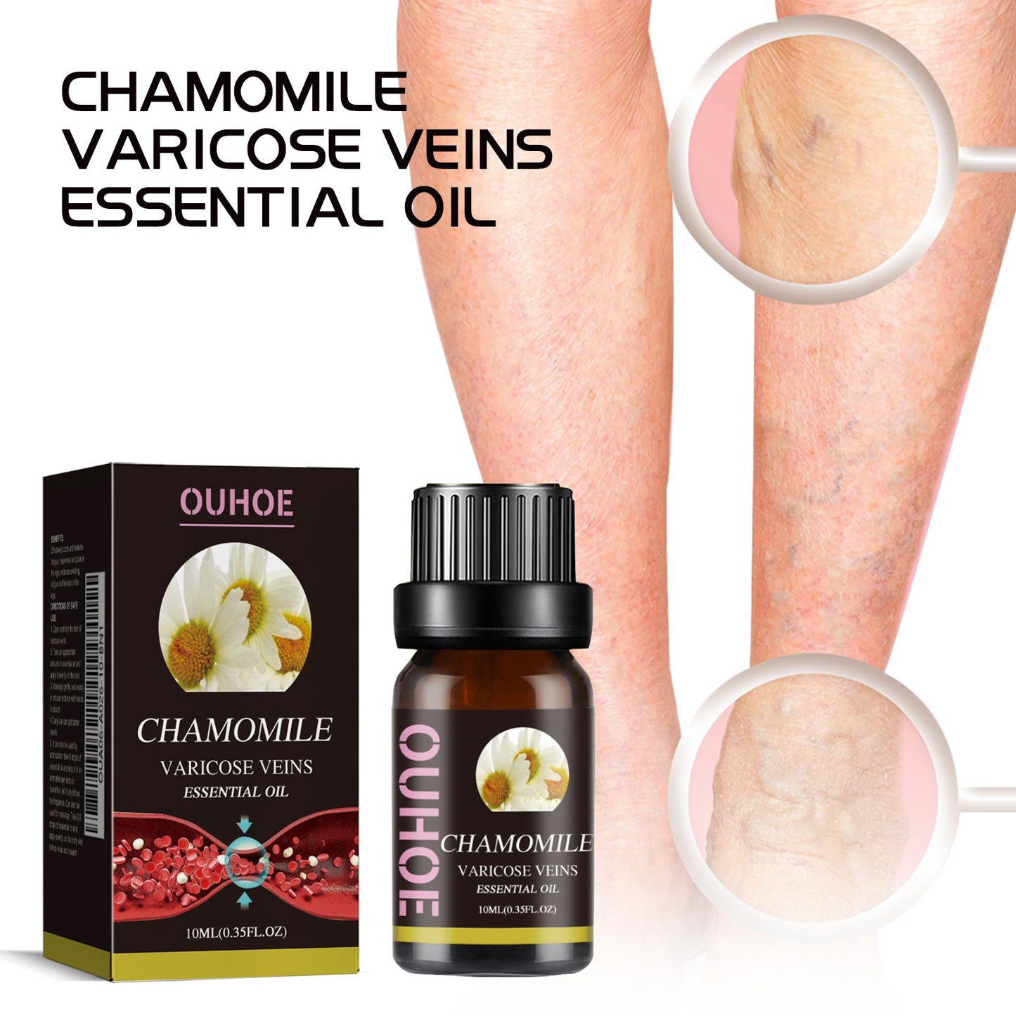 Chamomile Leg Essential Oil for Skin Care and Relaxation