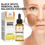 Skin Melanin Repair Essence, Brightening And Repairing Skin Removing Darkening And Dark Spots Hydrating Essence - Korvel