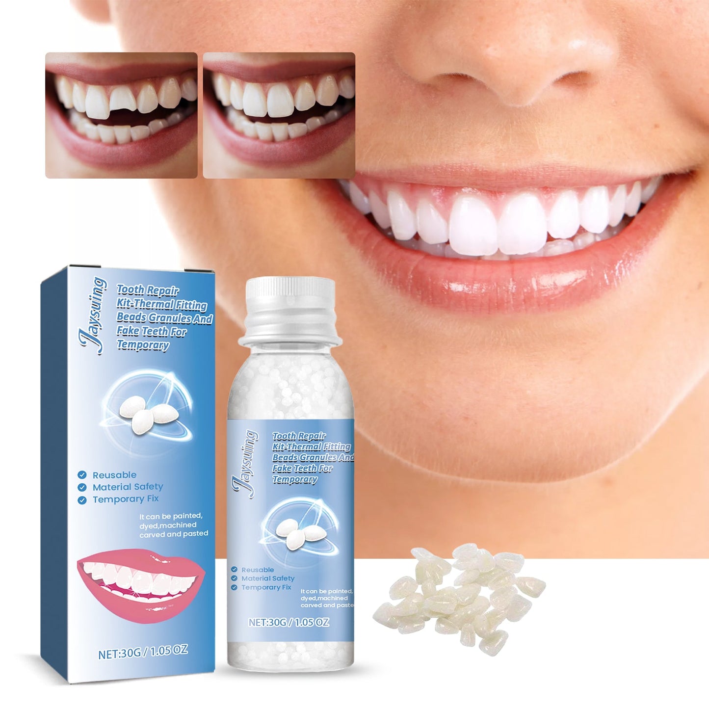 Premium Tooth Repair Kit for Quick Fixes