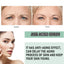 Ouhoe Collagen Anti-Wrinkle Facial Essence Reduces Fine Lines, Moisturizes, Tightens, And Moisturizes Skin - Korvel